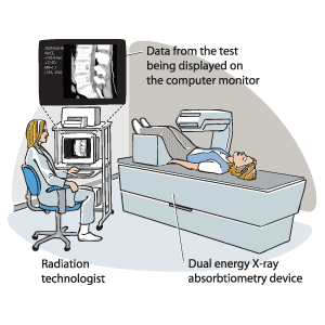 Body density screening